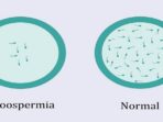 Perbandingan azoospermia dengan yang normal